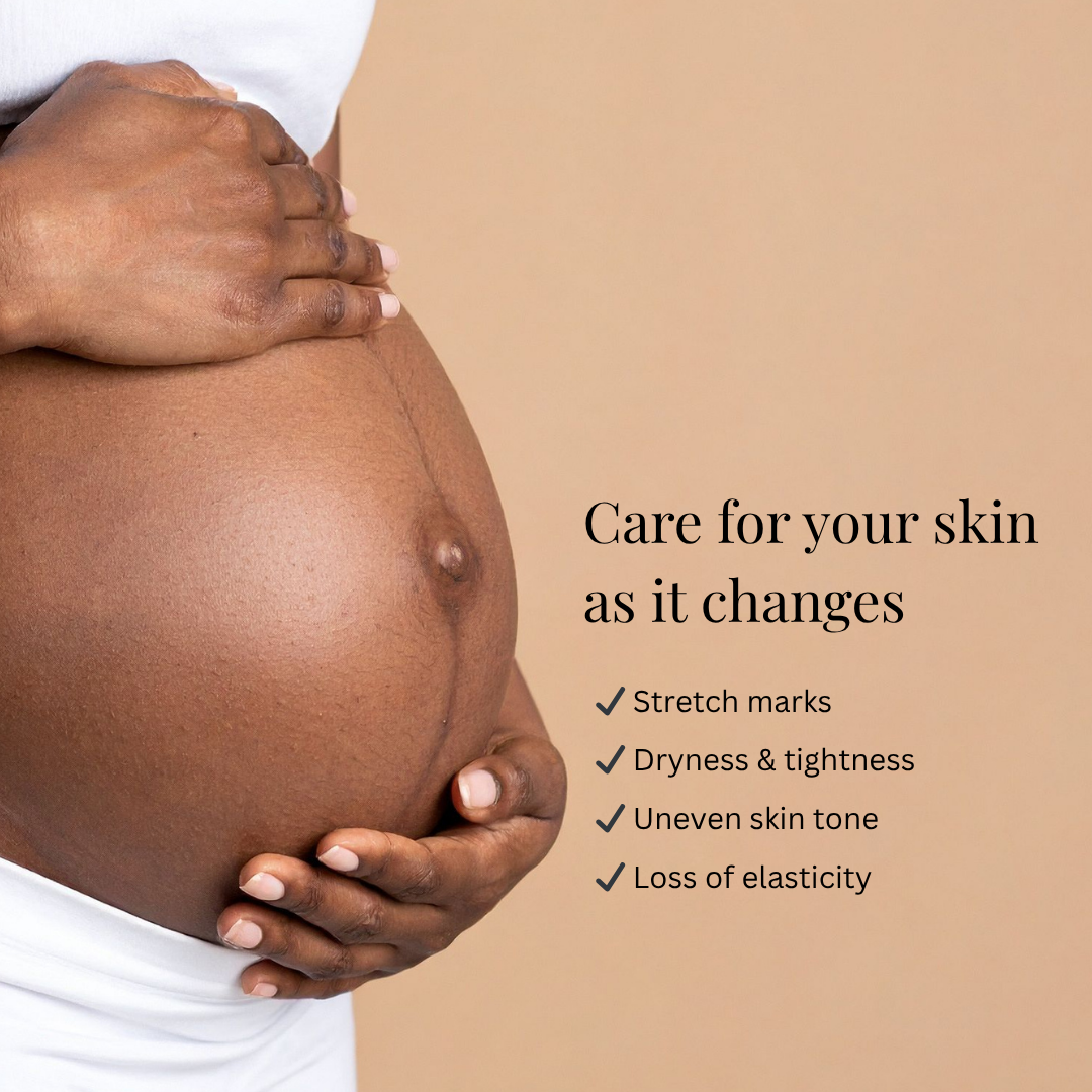 Pregnant belly with hands on a beige background, featuring text about skin care during pregnancy.